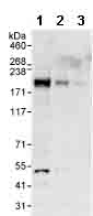 Western blot - Anti-ARAP1 antibody (AB99382), expandable thumbnail
