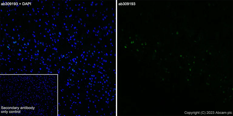 Immunohistochemistry (Frozen sections) - Anti-Arc antibody [EPR24093-90] (AB309193)