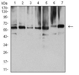 Western blot - Anti-ARD1A antibody [3G3B9] (AB234076)