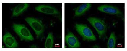 Immunocytochemistry/ Immunofluorescence - Anti-ARD1A antibody (AB155687), expandable thumbnail