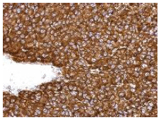 Immunohistochemistry (Formalin/PFA-fixed paraffin-embedded sections) - Anti-ARD1A antibody (AB155687), expandable thumbnail