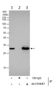 Immunoprecipitation - Anti-ARD1A antibody (AB155687)