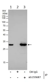 Immunoprecipitation - Anti-ARD1A antibody (AB155687)