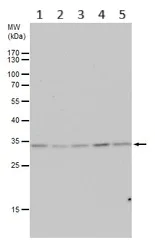 Western blot - Anti-ARD1A antibody (AB155687)