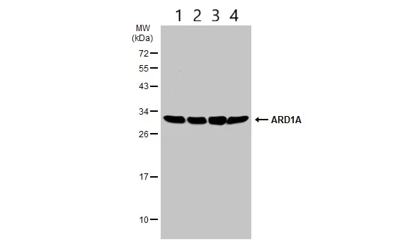 Western blot - Anti-ARD1A antibody (AB155687)