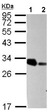 Western blot - Anti-ARD1A antibody (AB155687)