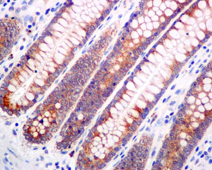 Immunohistochemistry (Formalin/PFA-fixed paraffin-embedded sections) - Anti-ARF GAP 2 antibody [EPR8497] (AB133768)