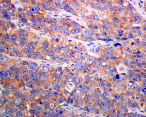 Immunohistochemistry (Formalin/PFA-fixed paraffin-embedded sections) - Anti-ARF GAP 2 antibody [EPR8497] (AB133768)