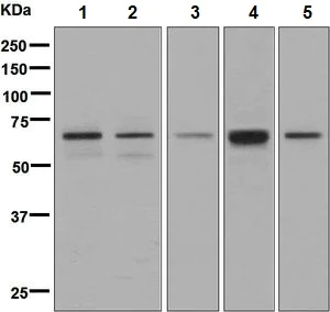 Western blot - Anti-ARF GAP 2 antibody [EPR8497] (AB133768)