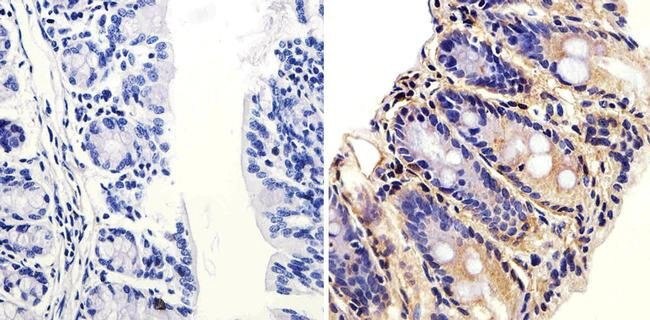 Immunohistochemistry (Formalin/PFA-fixed paraffin-embedded sections) - Anti-ARF1 antibody (AB183576), expandable thumbnail