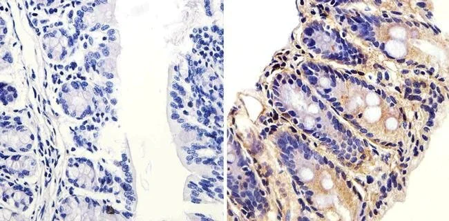 Immunohistochemistry (Formalin/PFA-fixed paraffin-embedded sections) - Anti-ARF1 antibody (AB183576)