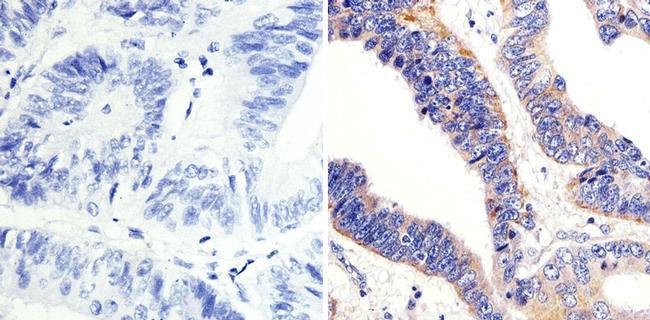 Immunohistochemistry (Formalin/PFA-fixed paraffin-embedded sections) - Anti-ARF1 antibody (AB183576), expandable thumbnail