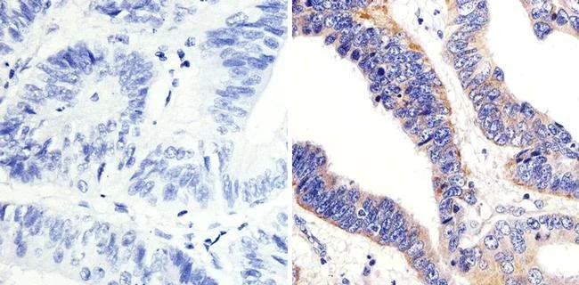 Immunohistochemistry (Formalin/PFA-fixed paraffin-embedded sections) - Anti-ARF1 antibody (AB183576)