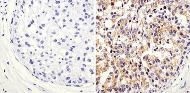 Immunohistochemistry (Formalin/PFA-fixed paraffin-embedded sections) - Anti-ARF1 antibody (ab183576), expandable thumbnail