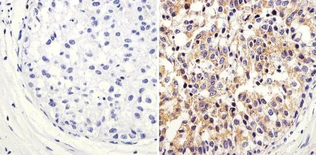 Immunohistochemistry (Formalin/PFA-fixed paraffin-embedded sections) - Anti-ARF1 antibody (AB183576)