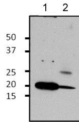 Immunoprecipitation - Anti-ARF1 antibody (ab183576), expandable thumbnail