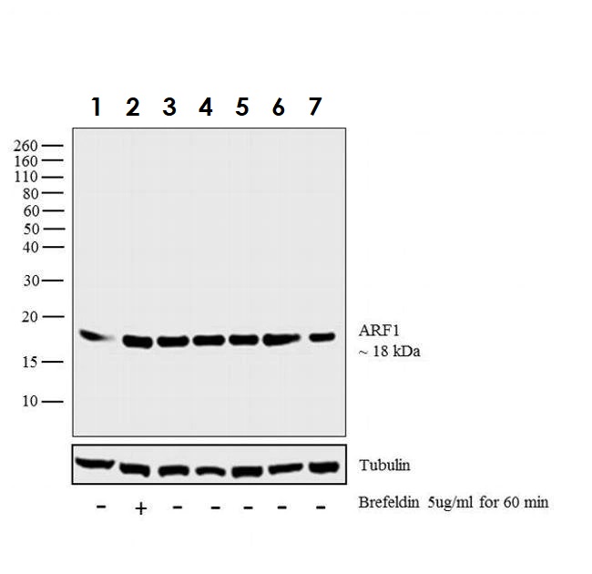 Western blot - Anti-ARF1 antibody (AB183576), expandable thumbnail