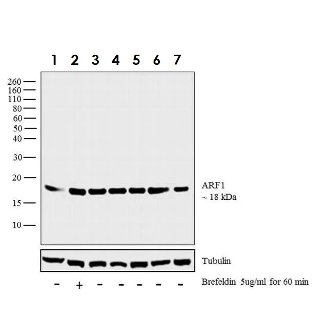 Western blot - Anti-ARF1 antibody (AB183576)