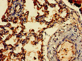 Immunohistochemistry (Formalin/PFA-fixed paraffin-embedded sections) - Anti-ARF1 antibody (AB236250)
