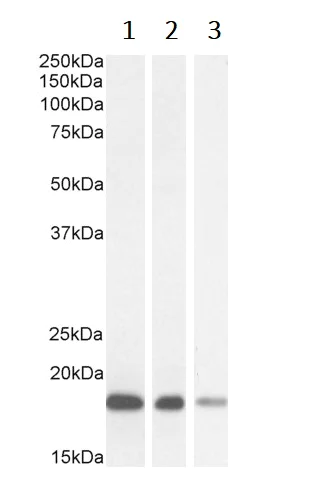 Western blot - Anti-ARF1 antibody (AB58578)