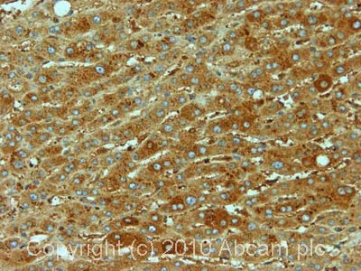 Immunohistochemistry (Formalin/PFA-fixed paraffin-embedded sections) - Anti-ARF1 antibody [ARFS 3F1] (AB11038)