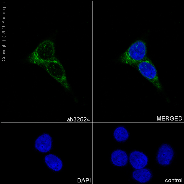 Immunocytochemistry/ Immunofluorescence - Anti-ARF1 + ARF3 antibody [EP442Y] (AB32524)