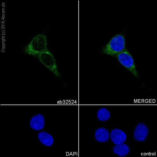 Immunocytochemistry/ Immunofluorescence - Anti-ARF1 + ARF3 antibody [EP442Y] (AB32524)