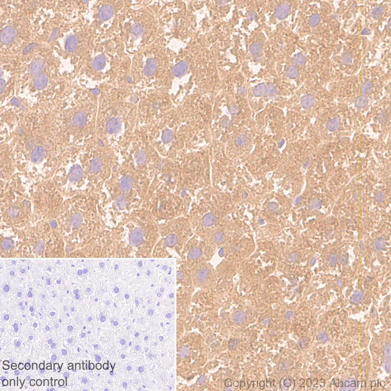 Immunohistochemistry (Formalin/PFA-fixed paraffin-embedded sections) - Anti-ARF1 + ARF3 antibody [EP442Y] (AB32524)