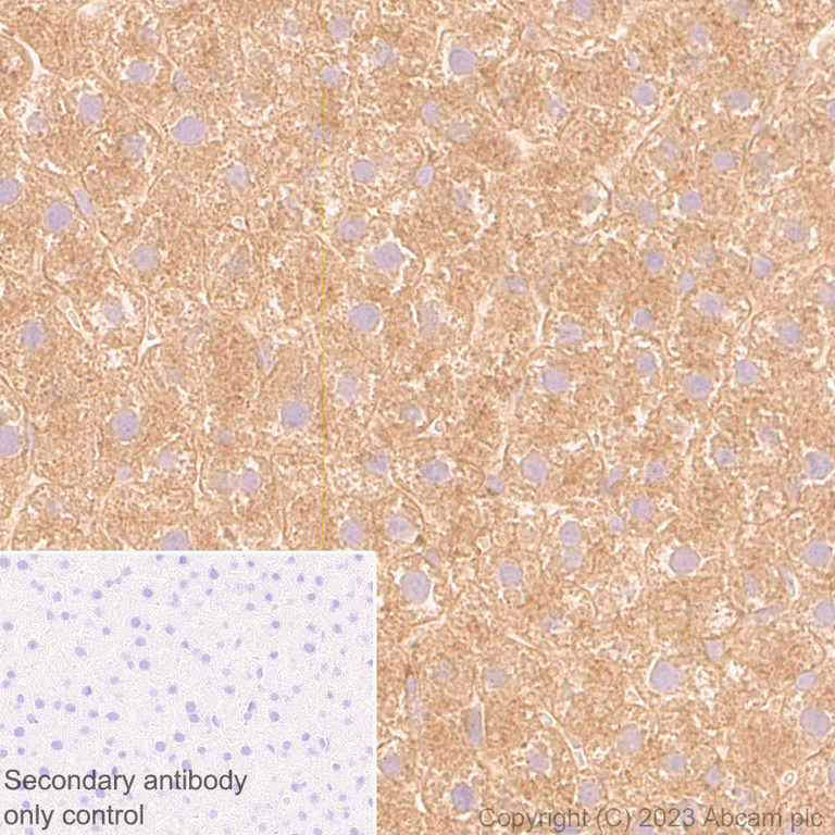 Immunohistochemistry (Formalin/PFA-fixed paraffin-embedded sections) - Anti-ARF1 + ARF3 antibody [EP442Y] (AB32524)