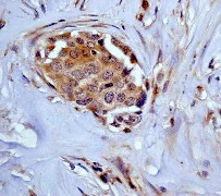 Immunohistochemistry (Formalin/PFA-fixed paraffin-embedded sections) - Anti-ARF1 + ARF3 antibody [EP442Y] (AB32524)