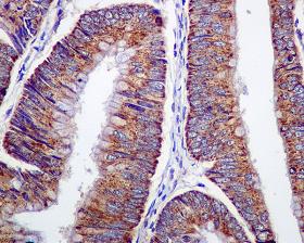 Immunohistochemistry (Formalin/PFA-fixed paraffin-embedded sections) - Anti-ARF1 + ARF3 antibody [EPR443] (AB108347), expandable thumbnail