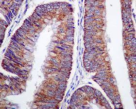 Immunohistochemistry (Formalin/PFA-fixed paraffin-embedded sections) - Anti-ARF1 + ARF3 antibody [EPR443] (AB108347)