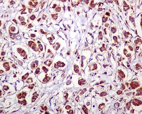 Immunohistochemistry (Formalin/PFA-fixed paraffin-embedded sections) - Anti-ARF1 + ARF3 antibody [EPR443] (AB108347), expandable thumbnail