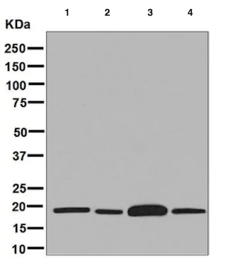 Western blot - Anti-ARF1 + ARF3 antibody [EPR8304(B)] (AB129003)