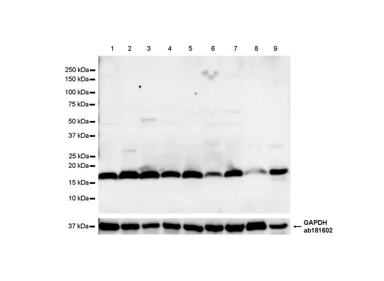 Western blot - Anti-ARF1+ARF3+ARF4+ARF6 antibody [RM1272] (AB322396)