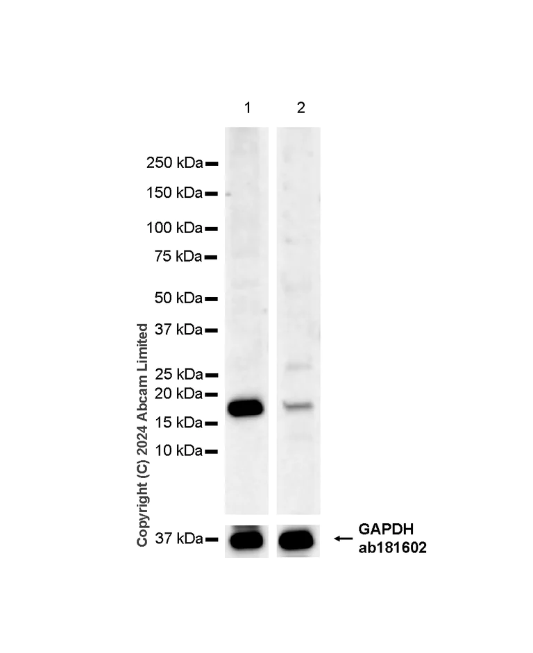 Western blot - Anti-ARF1+ARF3+ARF4+ARF6 antibody [RM1272] (AB322396)