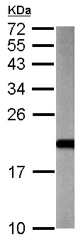 Western blot - Anti-ARF3 antibody (AB154383)