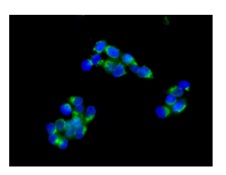 Immunocytochemistry/ Immunofluorescence - Anti-ARF4 antibody [EPR12133(B)] (AB171746)