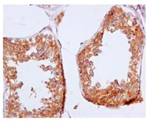 Immunohistochemistry (Formalin/PFA-fixed paraffin-embedded sections) - Anti-ARF4 antibody [EPR12133(B)] (AB171746)