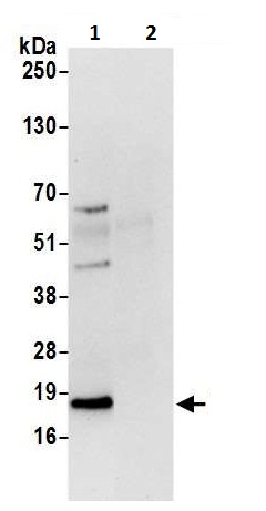Immunoprecipitation - Anti-ARF6 antibody (AB226389)