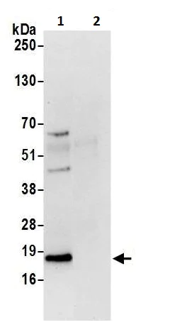 Immunoprecipitation - Anti-ARF6 antibody (AB226389)