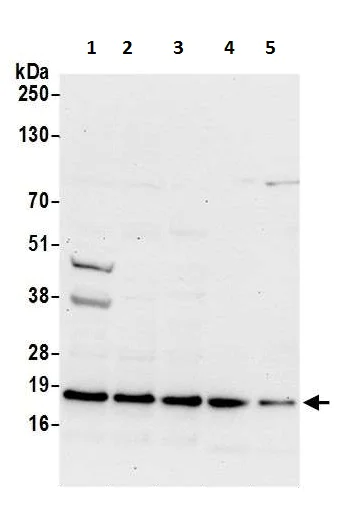 Western blot - Anti-ARF6 antibody (AB226389)