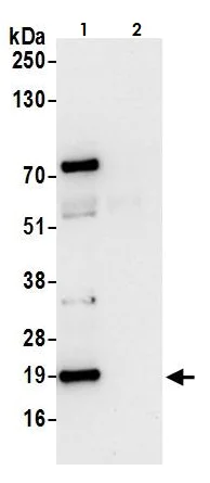 Immunoprecipitation - Anti-ARF6 antibody (AB264381)