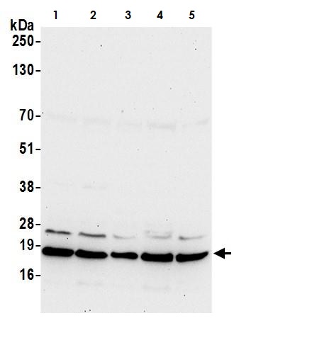Western blot - Anti-ARF6 antibody (AB264381)