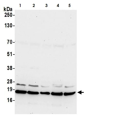 Western blot - Anti-ARF6 antibody (AB264381)