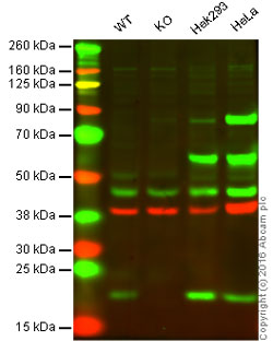 Western blot - Anti-ARF6 antibody [EPR8357] (AB131261)