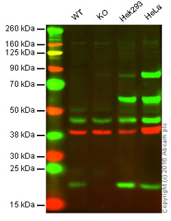 Western blot - Anti-ARF6 antibody [EPR8357] (AB131261)