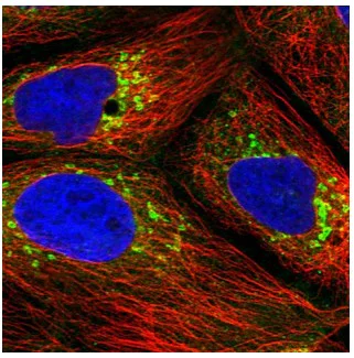 Immunocytochemistry - Anti-ARFGAP1 antibody (AB204405)