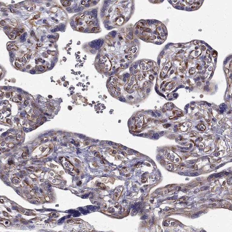 Immunohistochemistry (Formalin/PFA-fixed paraffin-embedded sections) - Anti-ARFGAP1 antibody (AB204405)