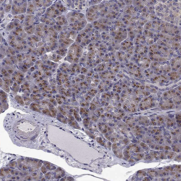 Immunohistochemistry (Formalin/PFA-fixed paraffin-embedded sections) - Anti-ARFGAP1 antibody (AB204405)